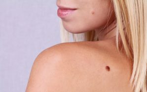 Melanoma Types: What You Need To Know
