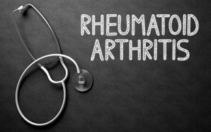 Rheumatoid Arthritis Explained